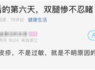 阳后第六天有人出现新症状！不少人中招...医生：此类情况及时就医
