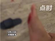 顾客称酒店拖鞋内藏刀片划伤脚底 索赔1万酒店只出1千